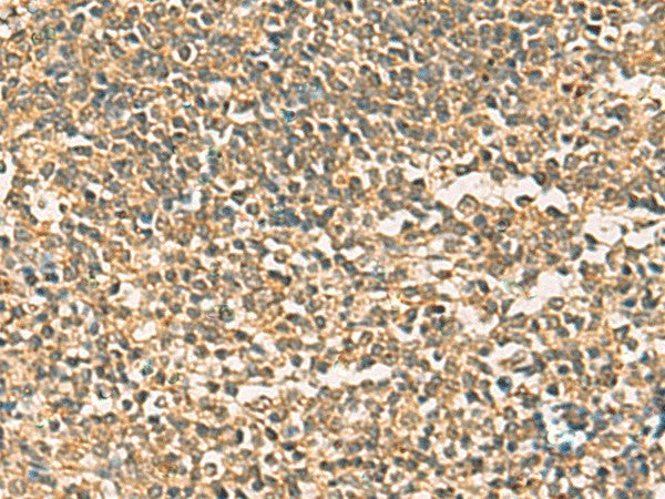 Immunohistochemistry of paraffin-embedded Human tonsil tissue using THG1L Polyclonal Antibody at dilution of 1:50(×200)