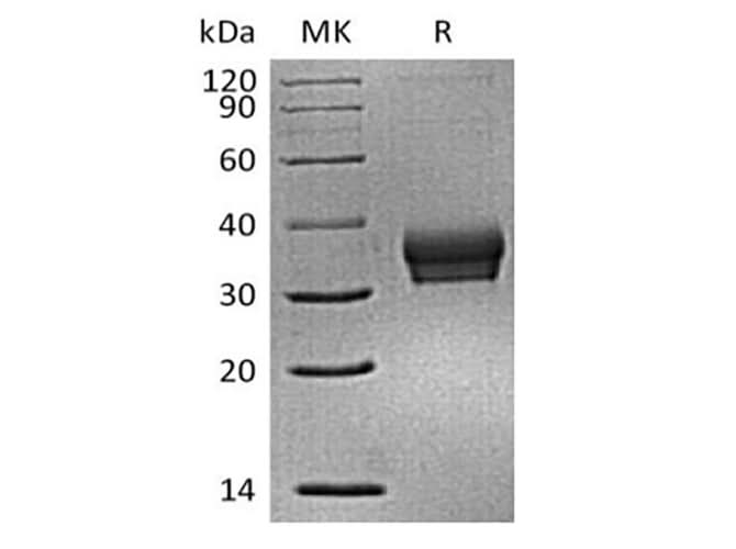 Recombinant Mouse Sialic acid-binding Ig-like lectin 15/Siglec-15/CD33L3 (C-6His) - ABMIUM