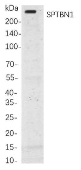 Anti-Human/Mouse/Rat SPTBN1 Antibody [B827]