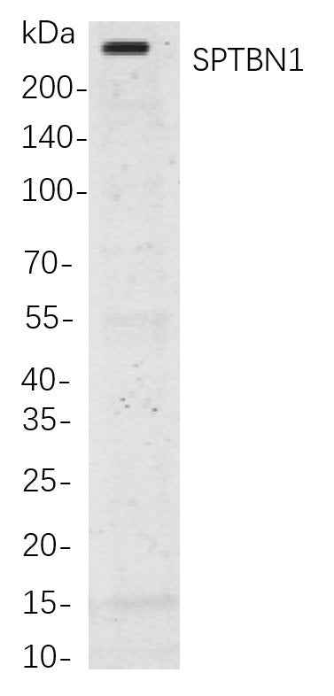 Anti-Human/Mouse/Rat SPTBN1 Antibody [B827]