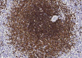 Anti-Human CD22 Antibody [A1126] - ABMIUM