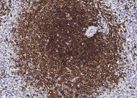 Anti-Human CD22 Antibody [A1126] - ABMIUM