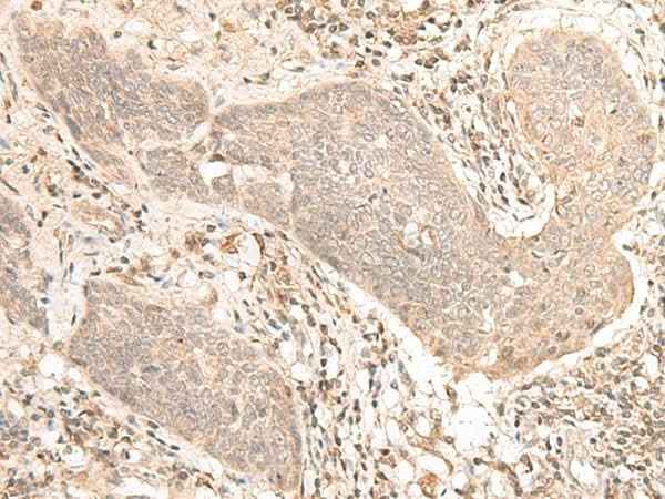 Anti-Human/Mouse/Rat VPS50 Antibody
