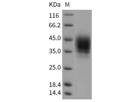 Recombinant Rat CD48 Protein (His Tag) - ABMIUM