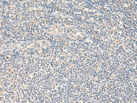 Immunohistochemistry of paraffin-embedded Human tonsil tissue using NEGR1 Polyclonal Antibody at dilution of 1:90(×200)