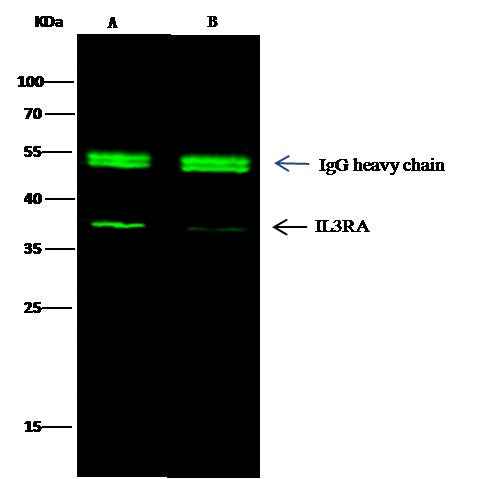 Anti-Human IL3Ra Antibody [B113] - ABMIUM