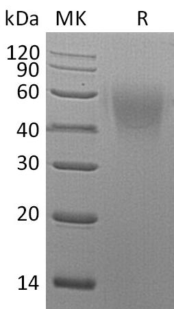 Recombinant Mouse CD86/B7-2 Protein (His Tag) - ABMIUM