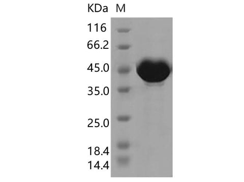 Recombinant SARS-CoV-2 N Protein (P80R)(His Tag) - ABMIUM