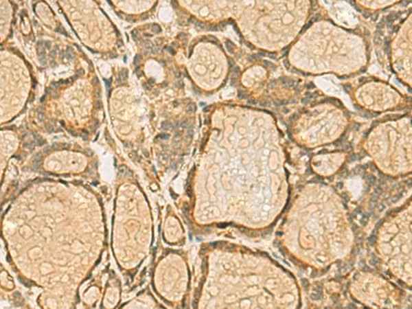 Anti-Human HORMAD2 Antibody