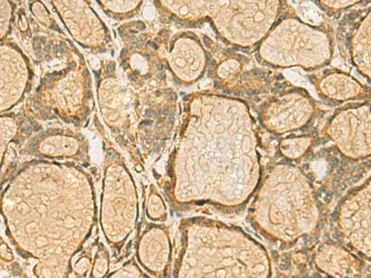 Anti-Human HORMAD2 Antibody