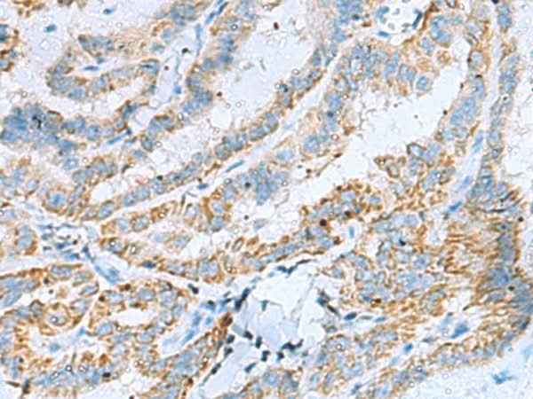 Anti-Human/Mouse/Rat KIF5A Antibody