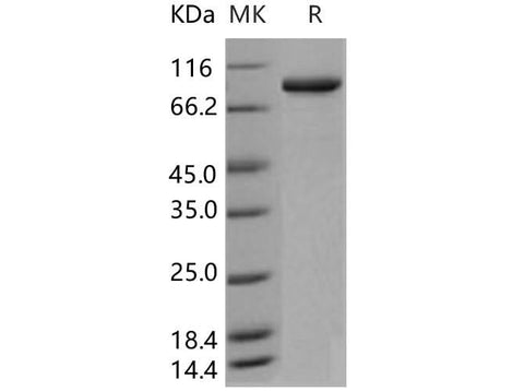 Recombinant Human ACO1/irp1 Protein (His Tag) - ABMIUM