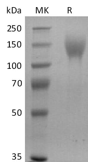 Recombinant Human CEACAM5/CD66e/CEA (C-6His-Avi) Biotinylated - ABMIUM