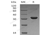 Recombinant Human PBLD/MAWBP Protein (His Tag) - ABMIUM
