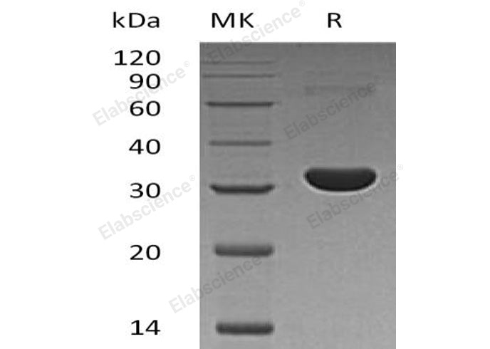 Recombinant Human PBLD/MAWBP Protein (His Tag) - ABMIUM