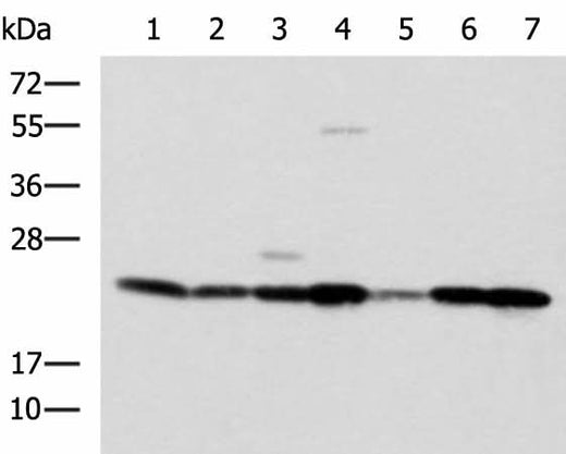 Western blot analysis of SKOV3 Hela cell Mouse liver tissue Mouse heart tissue Human placenta tissue HepG2 cell Human heart tissue lysates using ATP5O Polyclonal Antibody at dilution of 1:1250