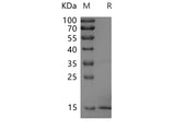 SDS-PAGE analysis of Rat FGF2 proteins, 2 μg/lane of Recombinant Rat FGF2 proteins was resolved with SDS-PAGE under reducing conditions, showing bands at 17.5 kDa.