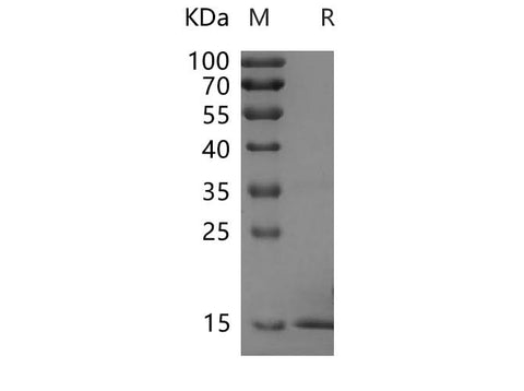 SDS-PAGE analysis of Rat FGF2 proteins, 2 μg/lane of Recombinant Rat FGF2 proteins was resolved with SDS-PAGE under reducing conditions, showing bands at 17.5 kDa.