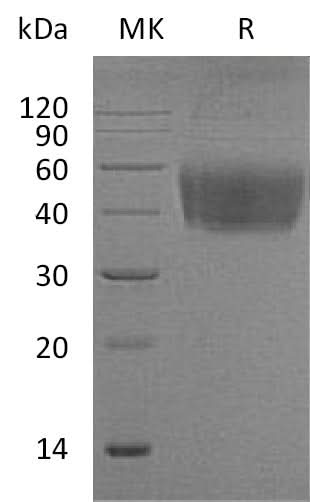 Recombinant Mouse CD80/B7-1 Protein (His Tag) - ABMIUM