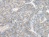 Anti-Human DGKI Antibody - ABMIUM