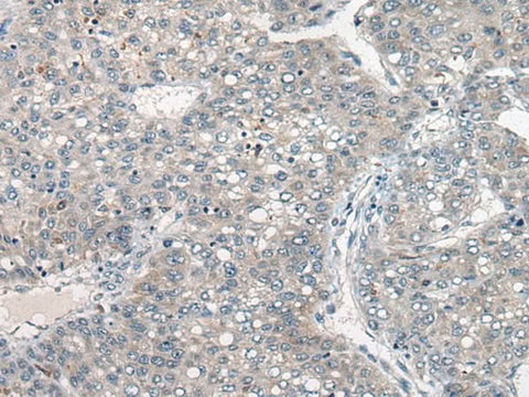 Anti-Human DGKI Antibody - ABMIUM