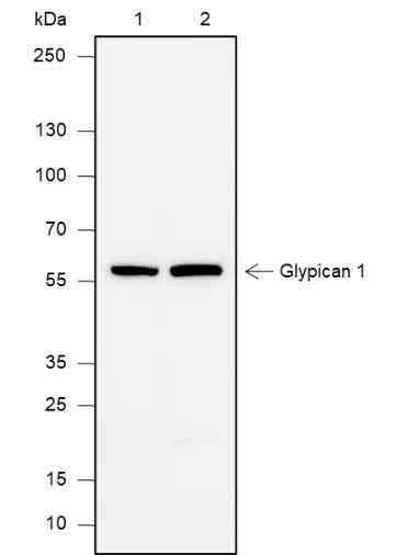 Anti-Human Glypican 1 Antibody [A627] - ABMIUM