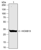 Anti-Human HOXB13 Antibody [A632]