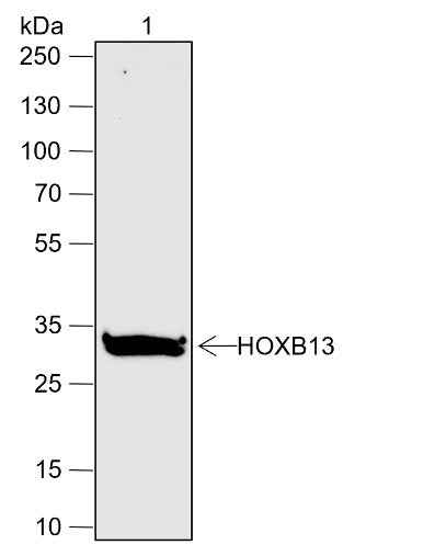 Anti-Human HOXB13 Antibody [A632] - ABMIUM