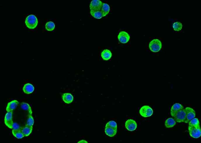 Anti-Human REG1A Antibody [A1062] - ABMIUM