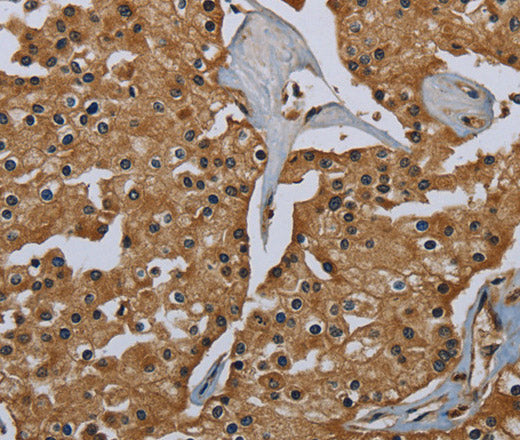 Anti-Human GBP5 Antibody - ABMIUM