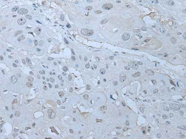 Anti-Human/Mouse/Rat HUWE1 Antibody