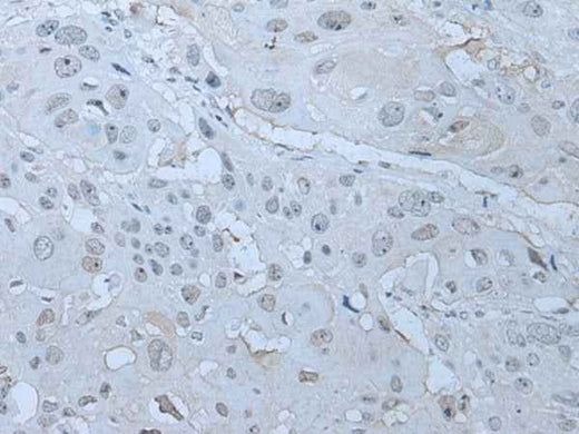Anti-Human/Mouse/Rat HUWE1 Antibody