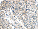 Anti-Human/Mouse IQGAP2 Antibody - ABMIUM