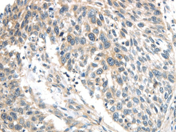 Anti-Human/Mouse IQGAP2 Antibody - ABMIUM