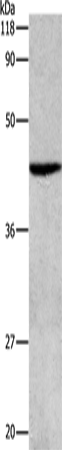 Anti-Human/Mouse APG4B Antibody - ABMIUM