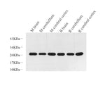 Western Blot analysis of various samples using PGP 9.5 Polyclonal Antibody at dilution of 1:600.