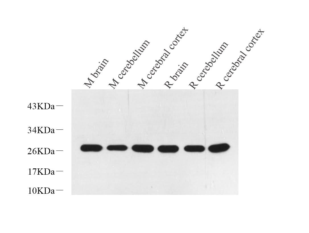 Western Blot analysis of various samples using PGP 9.5 Polyclonal Antibody at dilution of 1:600.