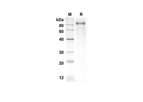 SDS-PAGE analysis of Human NRP1 proteins, 2 μg/lane of Recombinant Human NRP1 proteins was resolved with an SDS-PAGE under reducing conditions, showing bands at 68.4 kDa.