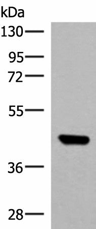 Western blot analysis of TM4 cell lysate using GTF3A Polyclonal Antibody at dilution of 1:550