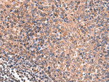 Immunohistochemistry of paraffin-embedded Human tonsil tissue using GALK2 Polyclonal Antibody at dilution of 1:160(×200)