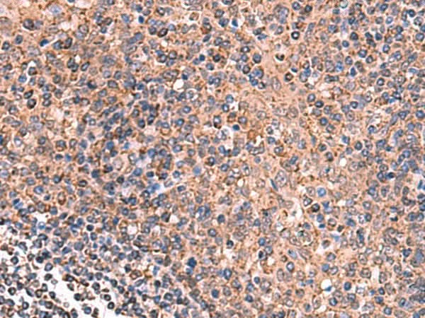 Immunohistochemistry of paraffin-embedded Human tonsil tissue using GALK2 Polyclonal Antibody at dilution of 1:160(×200)