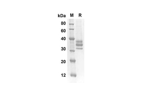 SDS-PAGE analysis of Mouse IL17R proteins, 2 μg/lane of Recombinant Mouse IL17RB proteins was resolved with SDS-PAGE under reducing conditions, showing bands at 23.9 kDa.