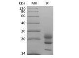Recombinant Cynomolgus Interleukin-17A/IL-17A (C-6His) - ABMIUM