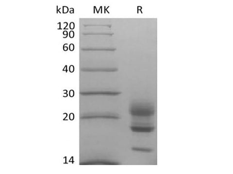 Recombinant Cynomolgus Interleukin-17A/IL-17A (C-6His) - ABMIUM