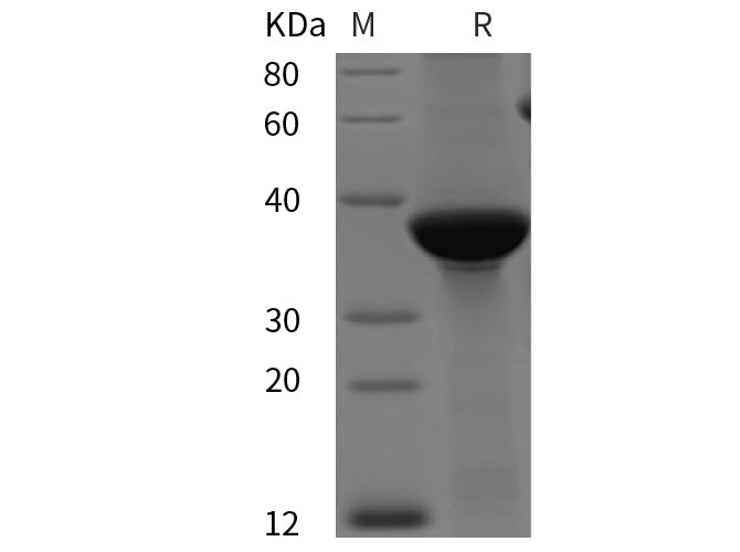 SDS-PAGE analysis of Human Glucagon-like peptide 1/GLP-1 proteins, 2 μg/lane of Recombinant Human Glucagon-like peptide 1/GLP-1 proteins was resolved with SDS-PAGE under reducing conditions, showing bands at 38 kDa.