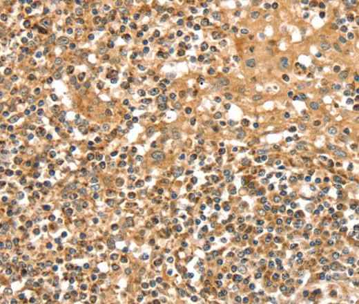 Anti-Human/Rat SLC8A3 Antibody