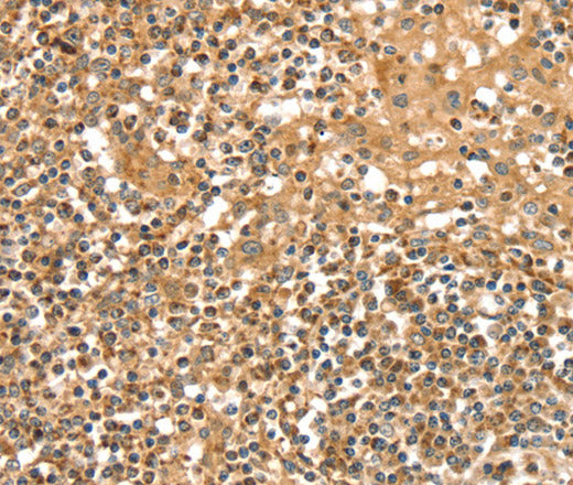 Anti-Human/Rat SLC8A3 Antibody - ABMIUM