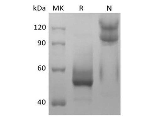 Recombinant Mouse TNFSF13B/BAFF/CD257 (N-mFc) - ABMIUM