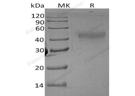 Recombinant Rat M-CSF/CSF1 Protein - ABMIUM