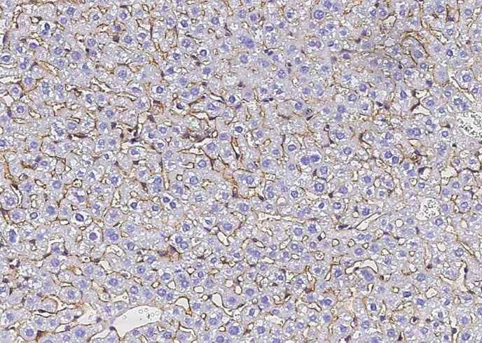 Anti-Mouse SerpinF2 Antibody [B415] - ABMIUM